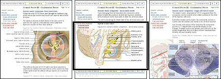 stran Cranial Nerve